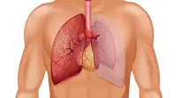 Akciğer kanserinde yeni tedavi yöntemi