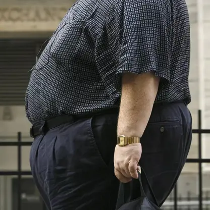 Obeziteli bireylere yönelik ayrımcılığın tedavilerini olumsuz etkilediği belirtiliyor