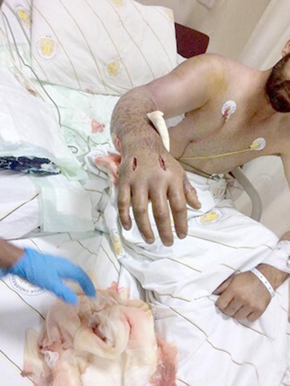 Yılan bu hale getirdi!