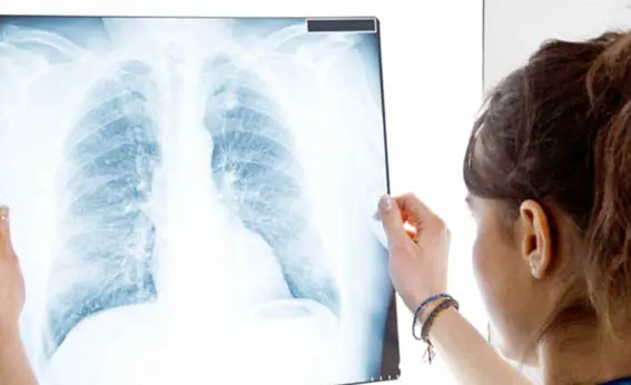 İnsan akciğerinde ilk kez mikroplastiğe rastlandı