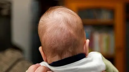 Bebeklerde kafa yapısı