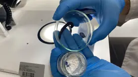 Sülük salgısıyla alternatif tedavi