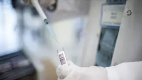 DSÖ, M çiçeği virüsü açıklaması