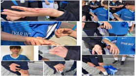 Diyarbakır ekibi revire döndü 